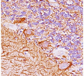 IHC testing of FFPE human cerebellum with Neurofilament antibody (clone NF421).