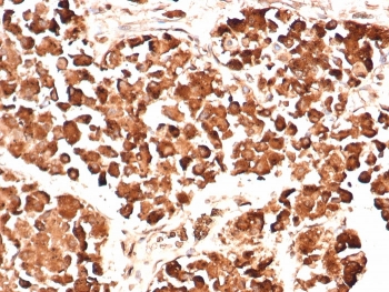 IHC testing of FFPE human pituitary gland stained with ACTH antibody (clone AH26). HIER: boil tissue sections in pH 9 10mM Tris with 1mM EDTA for 20 min and allow to cool before testing.