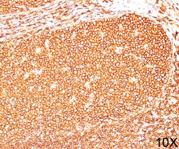 CD45RB antibody PD7/26 immunohistochemistry tonsil 10X