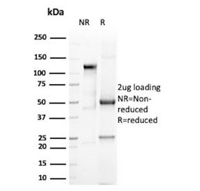 SDS-PAGE analysis of purified, BSA-free Eosinophil peroxidase antibody (clone AHE-1) as confirmation of integrity and purity.