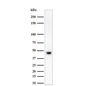 Western blot testing of human MCF7 cell lysate with HMW Cytokeratin antibody (clone 34BE12).