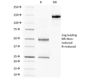 SDS-PAGE Analysis of Purified, BSA-Free HCG-beta Antibody (clone HCGb/211). Confirmation of Integrity and Purity of the Antibody.