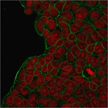 Immunofluorescent staining of human MCF-7 cells with HER2 antibody (green) and Reddot nuclear stain (red).