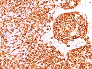 IHC test of FFPE human tonsil probed with CD45RB antibody