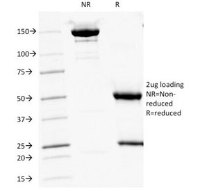 SDS-PAGE Analysis of Purified, BSA-Free CD16 Antibody (clone HuNK2). Confirmation of Integrity and Purity of the Antibody.