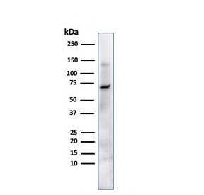 Western blot testing of human JEG-3 cells with Placental Alkaline Phosphatase antibody (clone ALP/870). Predicted molecular weight ~58 kDa but routinely visualized at 60-70 kDa.