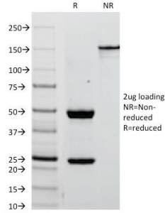 SDS-PAGE Analysis of Purified, BSA-Free Placental Alkaline Phosphatase Antibody (clone ALPP/238). Confirmation of Integrity and Purity of the Antibody.