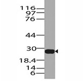 Western blot analysis of human stomach lysate using Granzyme B antibody. Predicted molecular weight: 29-37 kDa.