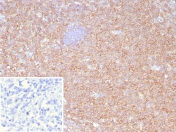 IHC staining of FFPE human tonsil tissue with HLA-B antibody (clone JOAN-1). HIER: boil tissue sections in pH 9 10mM Tris with 1mM EDTA for 20 min and allow to cool before testing.