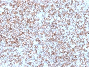 IHC: Formalin-fixed, paraffin-embedded human tonsil stained with HLA-DP / HLA-DR antibody (Bra-14).