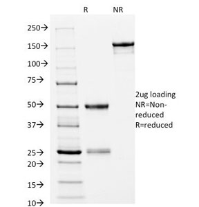 SDS-PAGE Analysis of Purified, BSA-Free HLA-DRB1 Antibody (clone L243). Confirmation of Integrity and Purity of the Antibody.
