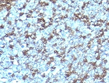 Formalin-fixed, paraffin-embedded human tonsil stained with anti-ICAM-3 antibody (SPM505)