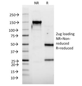 SDS-PAGE Analysis of Purified, BSA-Free Interferon alpha 2 Antibody (clone N39). Confirmation of Integrity and Purity of the Antibody.