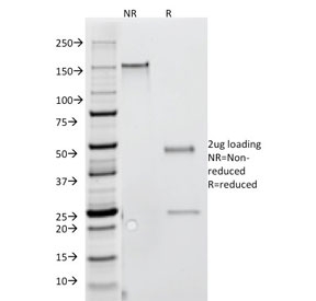 SDS-PAGE analysis of purified, BSA-free Interferon gamma antibody (clone G-23) as confirmation of integrity and purity.
