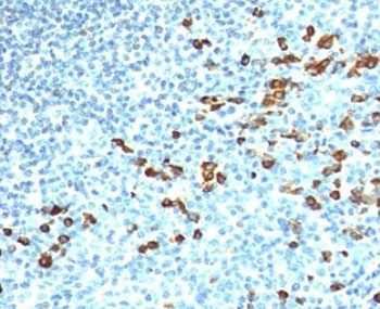IHC: Formalin-fixed, paraffin-embedded human tonsil stained with anti-IgM antibody (ICO-30)