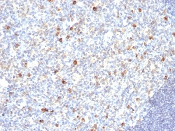 IHC: Formalin-fixed, paraffin-embedded human tonsil stained with anti-IgM antibody (SPM188).