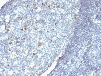 IHC: Formalin-fixed, paraffin-embedded human tonsil stained with anti-IgM antibody.