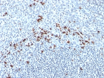 IHC: Formalin-fixed, paraffin-embedded human tonsil stained with anti-Kappa Light Chain antibody (clone Kap-56).