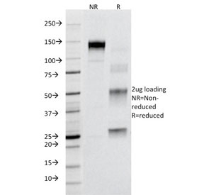SDS-PAGE Analysis of Purified, BSA-Free Fas Antibody (B-R18). Confirmation of Integrity and Purity of the Antibody.