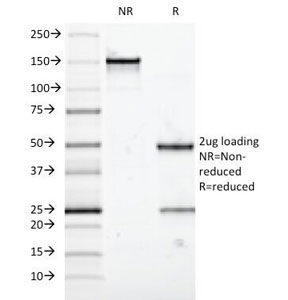 SDS-PAGE analysis of purified, BSA-free MUC5AC antibody (clone 58M1) as confirmation of integrity and purity.