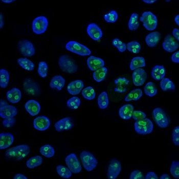 Immunofluorescent staining of PFA-fixed human HeLa cells with anti-Nucleolin antibody (clone SPM614, green) and DAPI (blue).