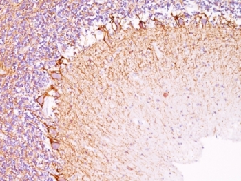 IHC: Formalin-fixed, paraffin-embedded human cerebellum stained with Neurofilament antibody (NR-4).