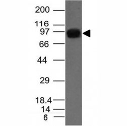 Western blot of A549 cell lysate using UACA antibody (AE-5)