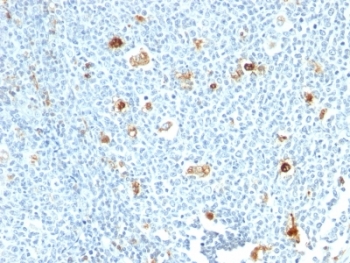 IHC: Formalin-fixed, paraffin-embedded human tonsil stained with Calprotectin antibody (CPT/1028)