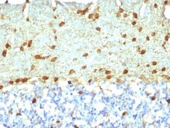 IHC: Formalin-fixed, paraffin-embedded rat brain stained with Fascin antibody (FSCN1/418)