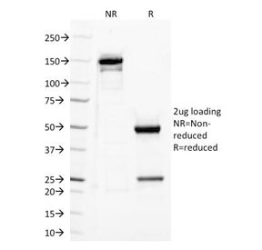 SDS-PAGE Analysis of Purified, BSA-Free TLR2 Antibody (clone TLR2/221). Confirmation of Integrity and Purity of the Antibody.