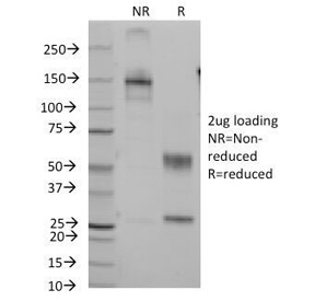 SDS-PAGE Analysis of Purified, BSA-Free CD7 Antibody (clone B-F12). Confirmation of Integrity and Purity of the Antibody.