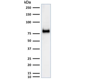 Western blot testing of human HeLa cell lysate with CD44 antibody (clone SPM521). Expected molecular weight ~81 kDa.