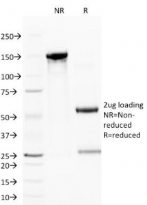 SDS-PAGE Analysis of Purified, BSA-Free CD59 Antibody (clone BRA-10G). Confirmation of Integrity and Purity of the Antibody.