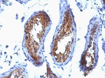 IHC: Formalin-fixed, paraffin-embedded human testicular carcinoma stained with MVP antibody (clone SPM280).