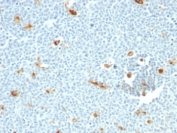 IHC: Formalin-fixed, paraffin-embedded human tonsil stained with Macrophage antibody (LN-5)