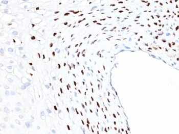 IHC: Formalin-fixed, paraffin-embedded human cervix stained with HPV-16 L1 antibody (clone HPV16L1/1058).