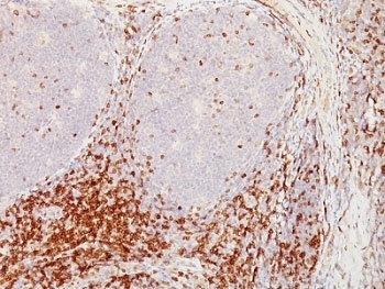 IHC analysis of formalin-fixed, paraffin-embedded human tonsil stained with CD5 antibody (clone CD5/54/F6).