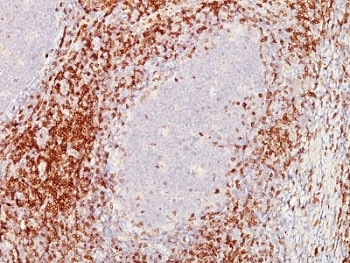 IHC: Formalin-fixed, paraffin-embedded human tonsil stained with CD5 antibody (C5/473 + CD5/54/F6)