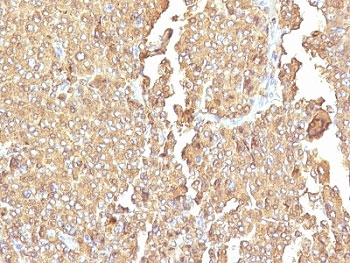 IHC: Formalin-fixed, paraffin-embedded human adrenal gland stained with Chromogranin A antibody (LK2H10 + PHE5).