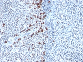 IHC: Formalin-fixed, paraffin-embedded human tonsil stained with Kappa Light Chain antibody (clone HP6053).