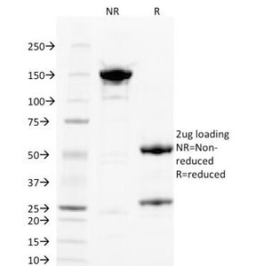 SDS-PAGE Analysis of Purified, BSA-Free PLGF Antibody (clone PLGF/93). Confirmation of Integrity and Purity of the Antibody.