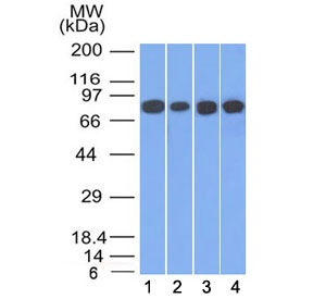 Western blot testing of human 1) HT20, 2) A549, 3) HEK293 and 4) A431 cell lysate with Plakoglobin antibody (clone 11E4). Predicted molecular weight: 80-87 kDa.