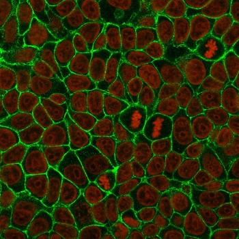 Immunofluorescent staining of human MCF7 cells with E-Cadherin antibody (green, clone 4A2) and Reddot nuclear stain (red).