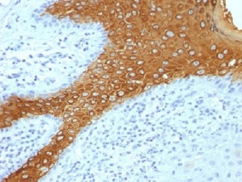 IHC testing of FFPE human skin with Keratin 10 antibody cocktail (KRT10/844). Required HIER: boil tissue sections in 10mM citrate buffer, pH 6, for 10-20 min.
