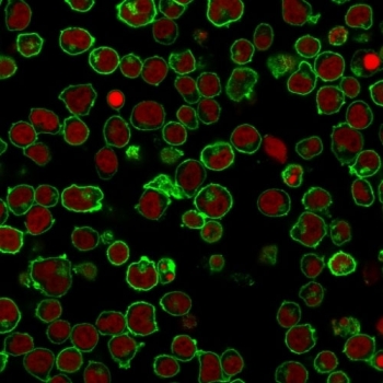 Immunofluorescent staining of PFA-fixed human Jurkat cells with CD45 antibody (clone PTPRC/1461, green) and Reddot nuclear stain (red).