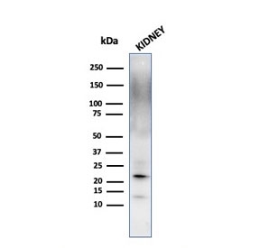 Western blot testing of human kidney lysate with Ferritin Light Chain antibody. Predicted molecular weight: ~20 kDa.