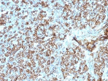 IHC testing of FFPE human tonsil tissue with HLA-DP/DQ/DR antibody (clone CR3/43). Required HIER: boil tissue sections in 10mM citrate buffer, pH 6, for 10-20 min.