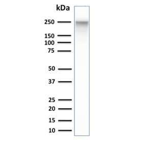 Western blot testing of human PANC-1 cell lysate with Spectrin beta III antibody. Predicted molecular weight ~246 kDa.