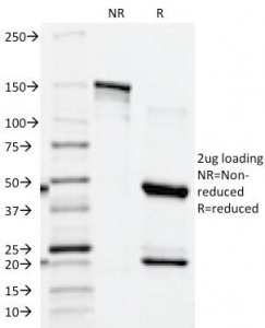 SDS-PAGE Analysis of Purified, BSA-Free PSAP Antibody (ACPP/1339). Confirmation of Integrity and Purity of the Antibody.