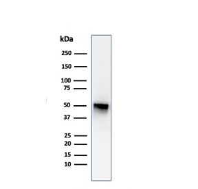 Western blot testing of human spleen lysate with Thymidine Phosphorylase antibody (clone P-GF.44C). Predicted molecular weight ~55 kDa.